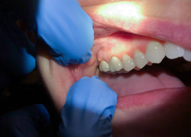 Best Urgent Care for Lost Fillings or Crowns in Lyman, SC
